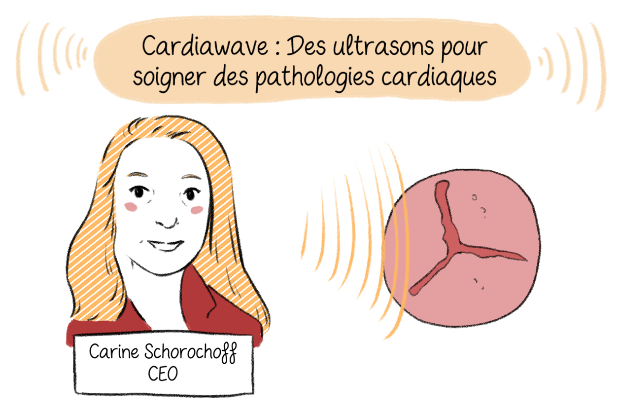 Cardiawave : des ultrasons pour soigner des pathologies cardiaques